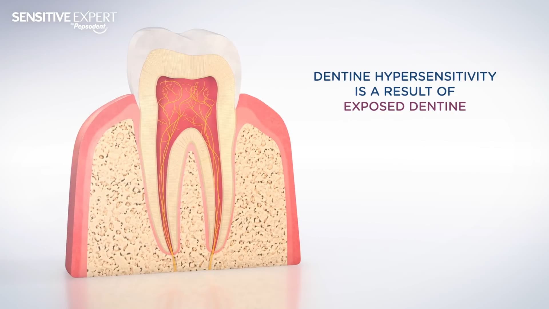 sensitive-expert-by-pepsodent-mode-of-action